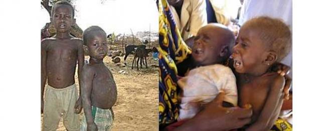 Somalia famine killed nearly 260,000 people, UN reports
