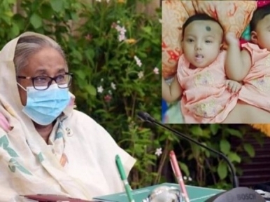 Conjoined twins to be separated, Prime Minister Hasina to take care of treatment cost